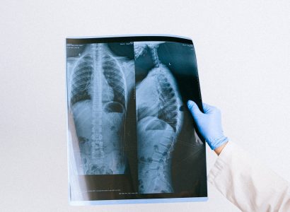 Лечение туберкулеза в Германии