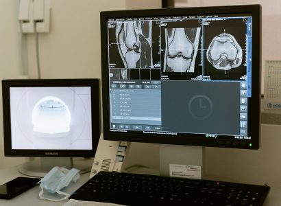 Лечение передней крестообразной связки в Германии