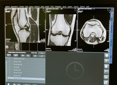 Операция по замене суставов в Германии