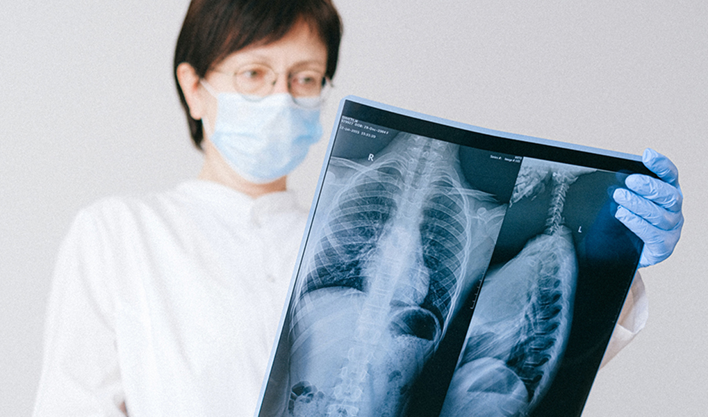 Отделение лечения легких. Врач с рентгеном легких. Картинка онкологии в Якутии.