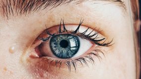 Синдром сухого глаза – лечение в Германии