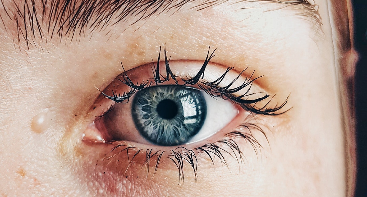 Существует 2 типа причин, приводящих к синдрому «сухого глаза»: