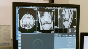 Эндопротезы в Германии: общий регистр дает преимущества для врачей и пациентов