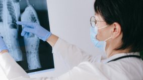 Цифровой рентген костно-мышечной системы
